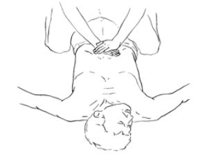 Example of Hemlich Maneuver for lying down patient. Press into  and up against stomach with a sharp thrusting motion.